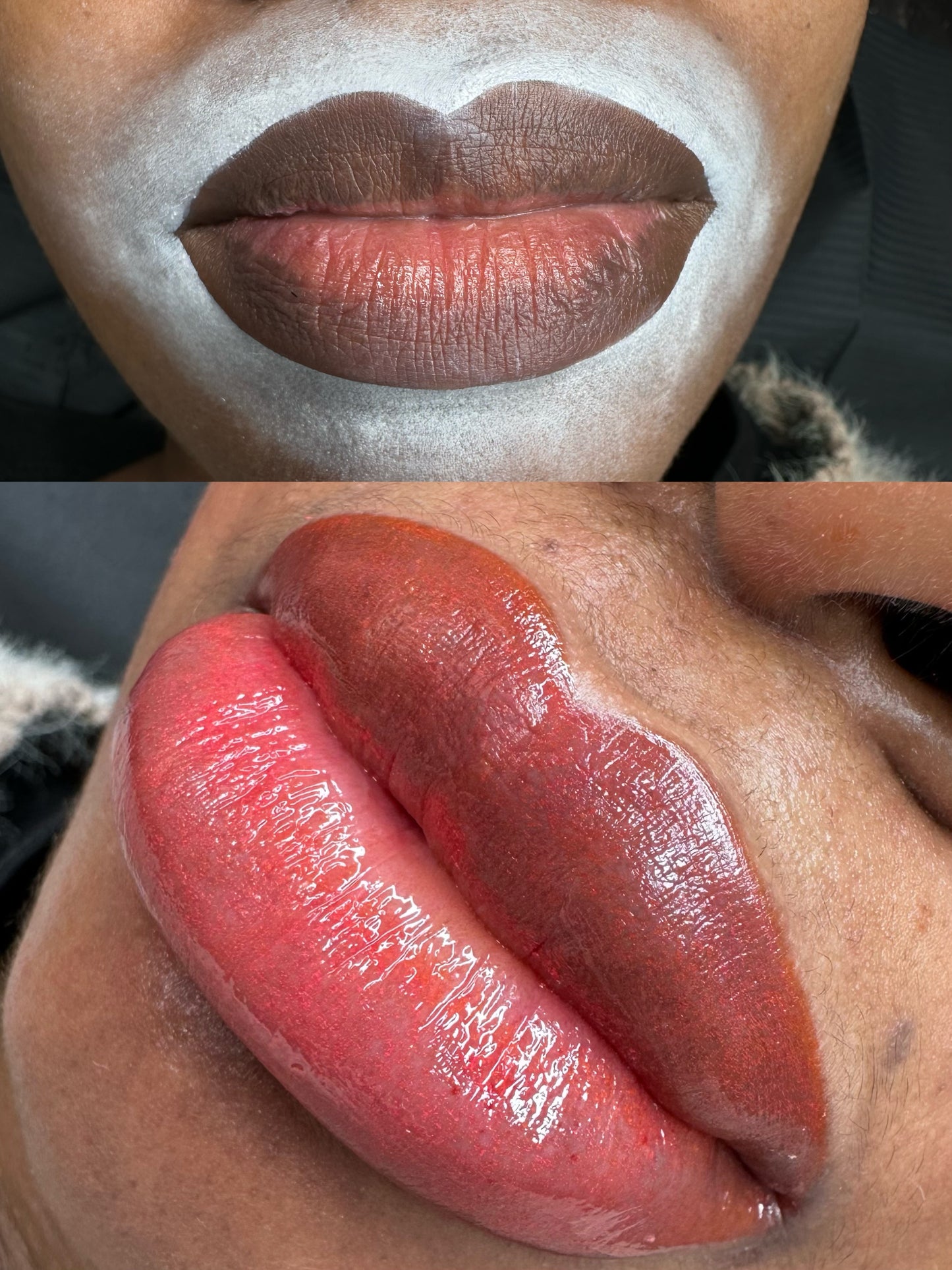 Dark Lip Neautralisation